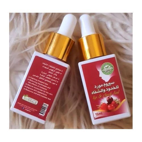 مورد الشفاة و الخدود